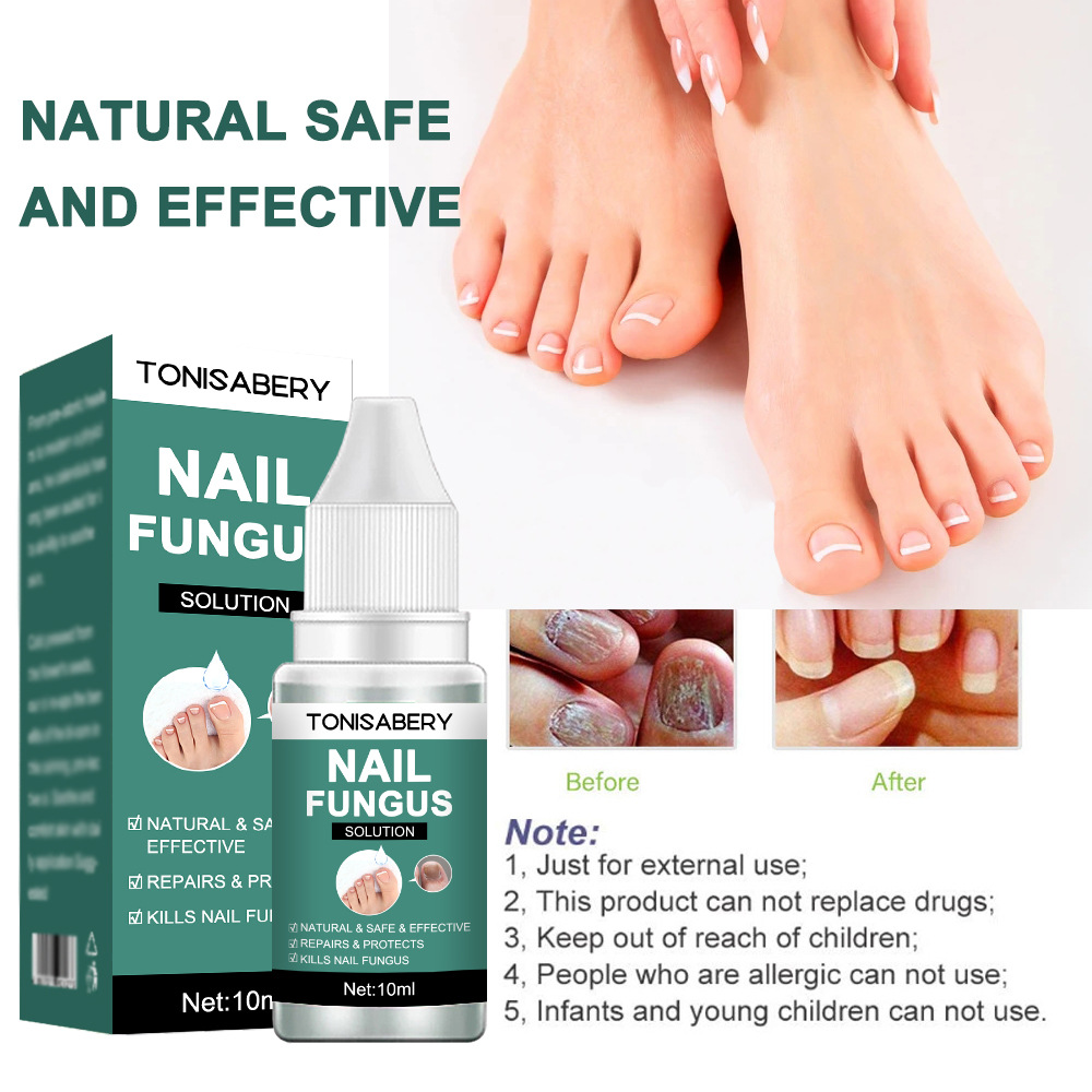 Nail Fungal Treatment Feet Care Essence Anti Infection Paronychia Onychomycosis Nail Fungus Removal Gel
