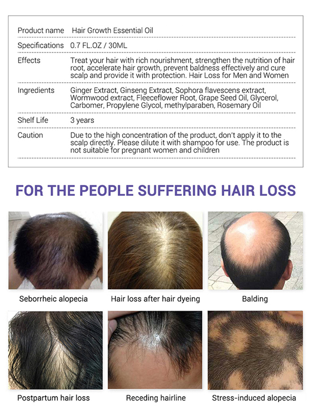 Ginger Hair Growth Spray Essential Oils Hair Loss Treatment Fast Grow Prevent Hair Dry 30ml