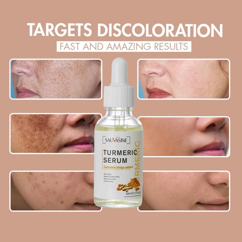 30ML Turmeric Face Serum Whitening Dark Spot Remover Acne Scar Bright Skin Corrector
