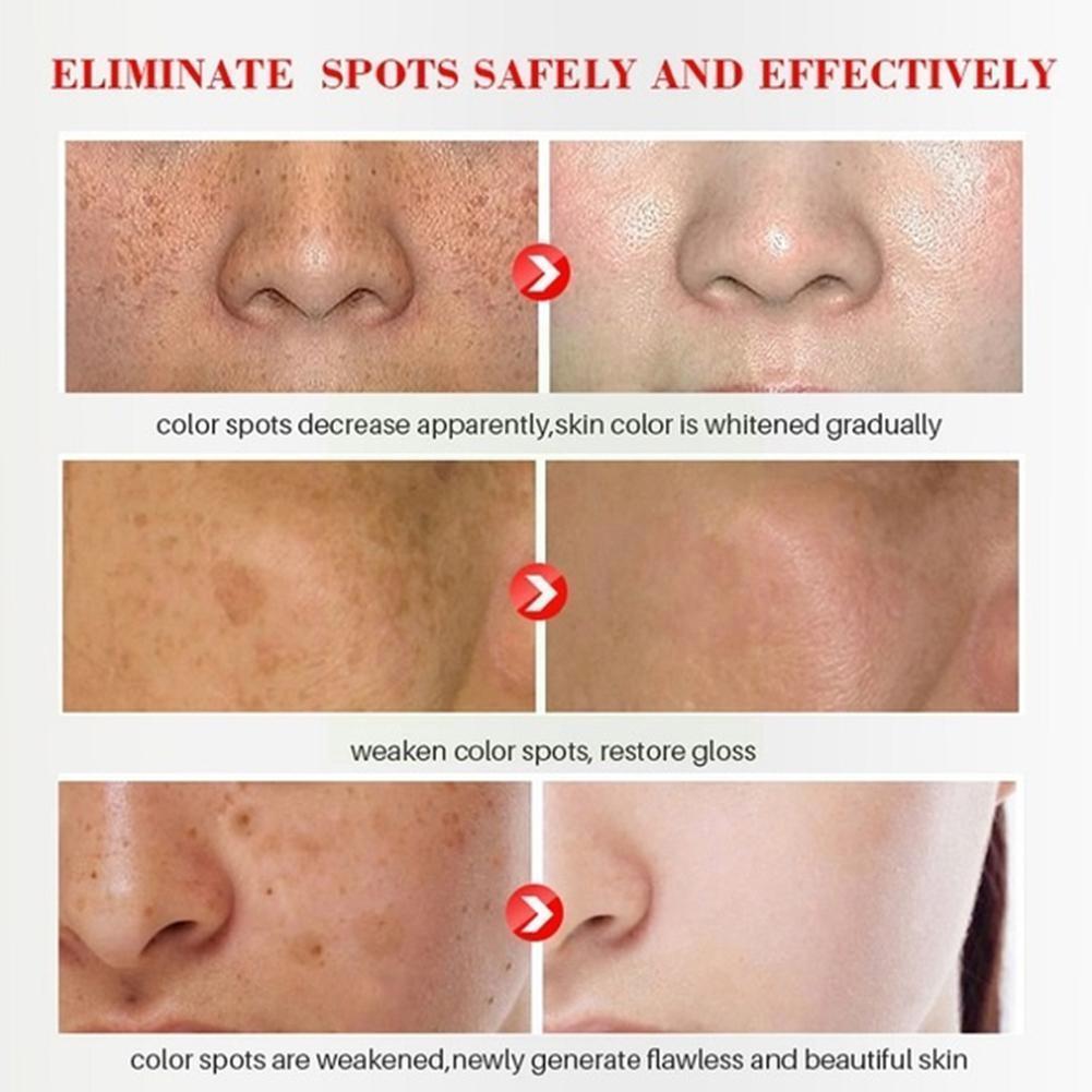 30ML Turmeric Face Serum Whitening Dark Spot Remover Acne Scar Bright Skin Corrector
